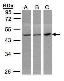 Anti-PGD Antibody