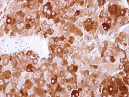 Anti-LTBP4 (N-term) Antibody