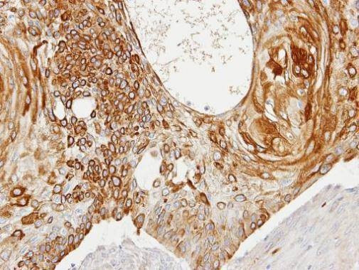 Anti-Creatine kinase (brain) Antibody