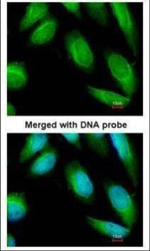 Anti-Creatine kinase (brain) Antibody
