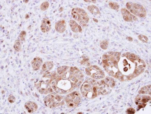 Anti-DDT Antibody