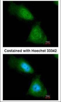 Anti-ENO1 Antibody