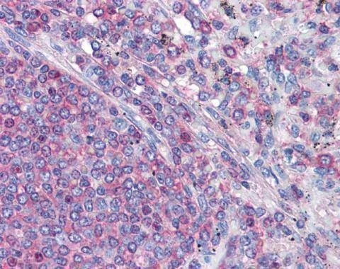 Anti-gamma Actin Antibody