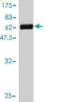 Anti-UBE2R2 Antibody