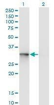 Anti-UBE2R2 Antibody