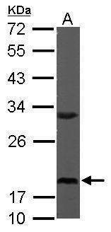 Anti-RPS10 Antibody