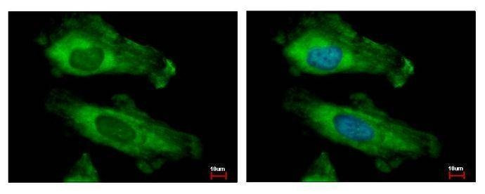 Anti-RPS10 Antibody