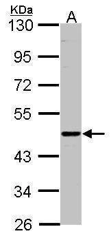 Anti-ENTPD6 Antibody