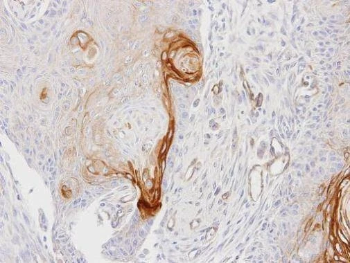 Anti-ENTPD6 Antibody
