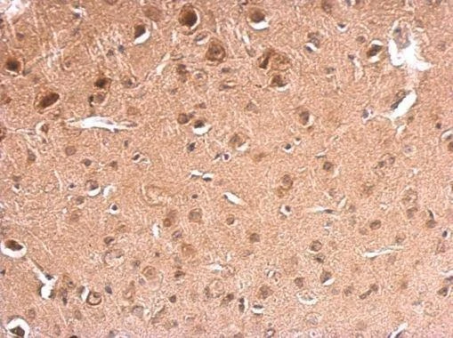 Anti-GAD67 Antibody
