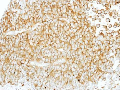 Anti-EMR1 (C-term) Antibody