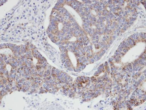 Anti-p21-ARC Antibody