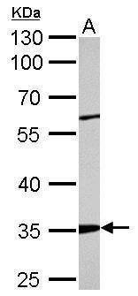 Anti-ARPC2 Antibody