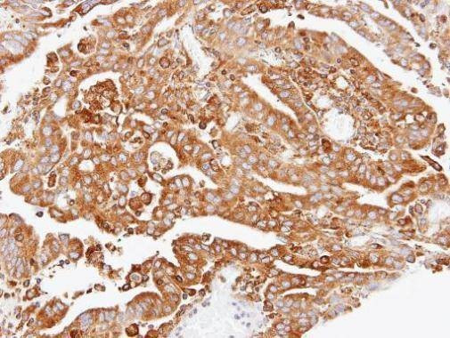 Anti-ARPC2 Antibody