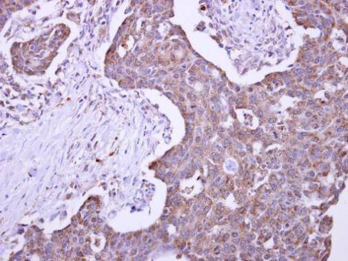 Anti-Malectin Antibody