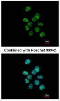 Anti-PUF60 Antibody