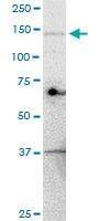 Anti-UBE4A Antibody