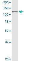 Anti-UBE4A Antibody