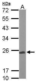 Anti-UQCRFS1 Antibody