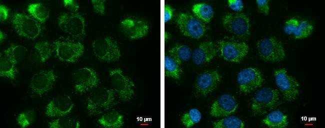 Anti-UQCRFS1 Antibody