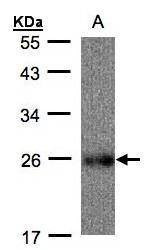 Anti-UQCRFS1 Antibody
