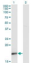 Anti-UBL4A Antibody