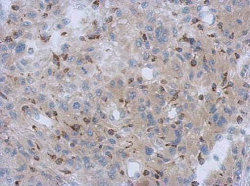Anti-NDUFV1 Antibody