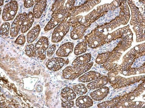 Anti-PKD2 Antibody