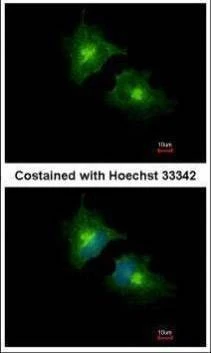 Anti-SCAMP3 Antibody