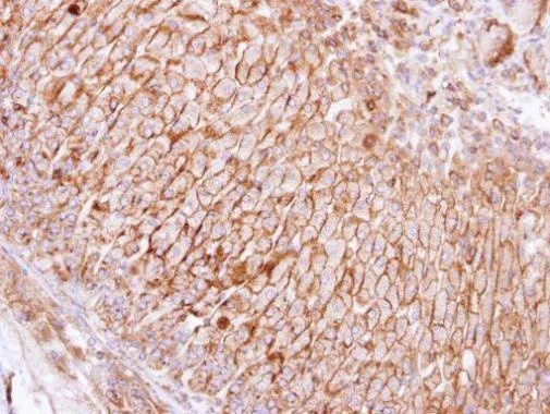 Anti-SCAMP3 Antibody