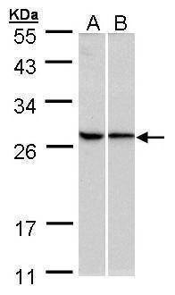 Anti-RPL13A Antibody