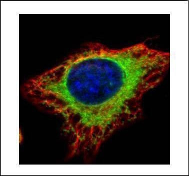 Anti-alpha Glucosidase II (N-term) Antibody