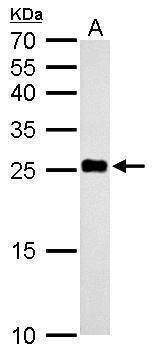 Anti-NDUFV2 Antibody