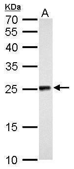 Anti-NDUFV2 Antibody