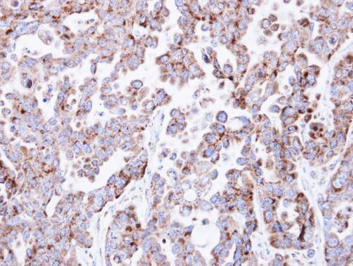 Anti-NDUFV2 Antibody