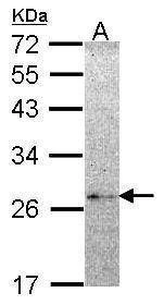 Anti-NME5 Antibody