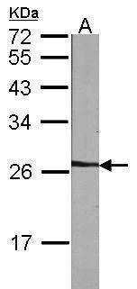 Anti-NME5 Antibody