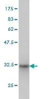 Anti-AGTRAP Antibody