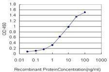 Anti-AGTRAP Antibody