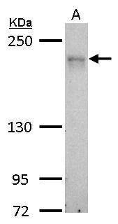 Anti-MRCK alpha Antibody