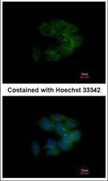 Anti-MRCK alpha Antibody