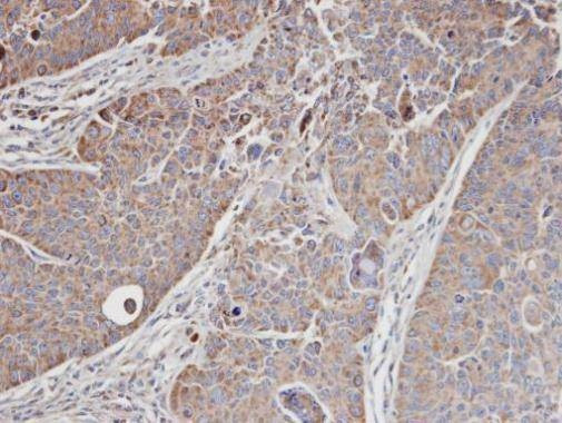 Anti-MRCK alpha Antibody