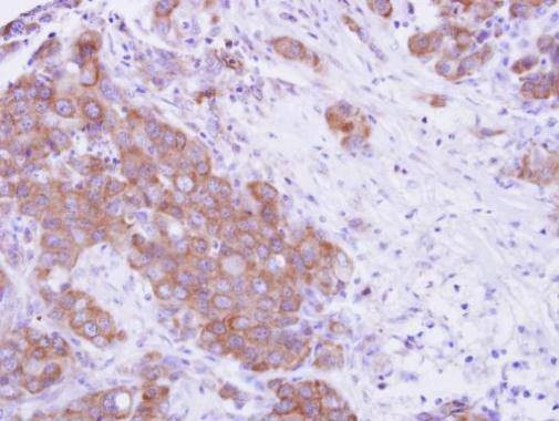 Anti-MPP3 Antibody