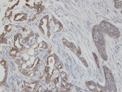 Anti-Cytokeratin 2 (internal) Antibody