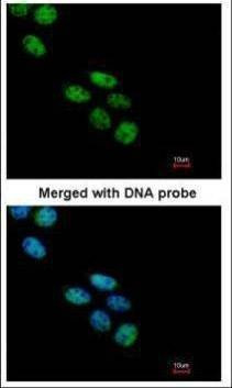 Anti-NOVA1 Antibody