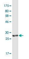 Anti-UCP1 Antibody
