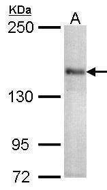 Anti-CACNA1S Antibody