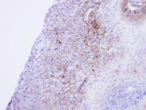 Anti-CACNA1S Antibody