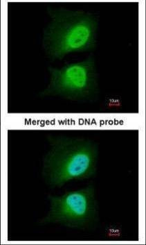 Anti-CSE1L Antibody