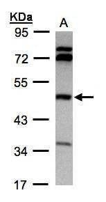 Anti-BHMT Antibody
